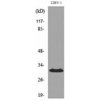 p57 Polyclonal Antibody