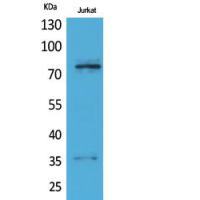 p73 Polyclonal Antibody