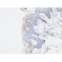 p73 Polyclonal Antibody