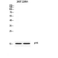 p16 Polyclonal Antibody