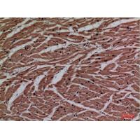P2X3 Polyclonal Antibody