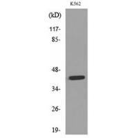 P2X3 Polyclonal Antibody