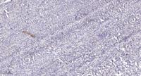 Rhophilin Polyclonal Antibody
