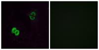 Olfactory receptor 2T1 Polyclonal Antibody