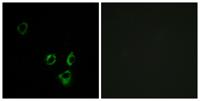 Olfactory receptor 2T5/2T29 Polyclonal Antibody