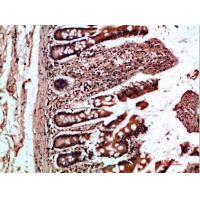 OSM Polyclonal Antibody
