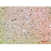 OSM Polyclonal Antibody