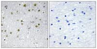 NRIP2 Polyclonal Antibody
