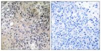 N-Shc Polyclonal Antibody