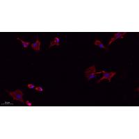 NTCP Polyclonal Antibody