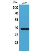 NTCP Polyclonal Antibody