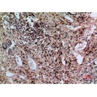 NTCP Polyclonal Antibody