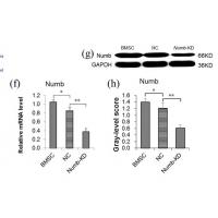 NUMB Polyclonal Antibody