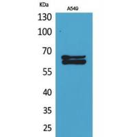 NUMB Polyclonal Antibody