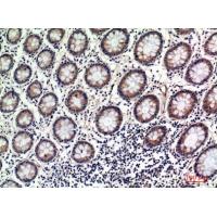 OAS2 Polyclonal Antibody