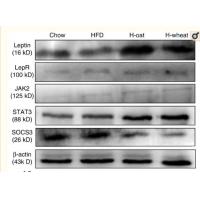 Ob-R Polyclonal Antibody