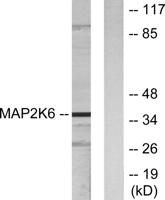 MEK-6 Polyclonal Antibody