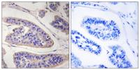 Mena Polyclonal Antibody