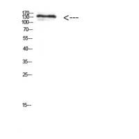 MIB1 Polyclonal Antibody