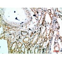 MIB1 Polyclonal Antibody