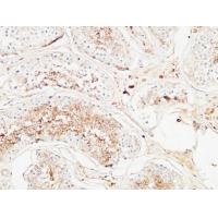 MIB1 Polyclonal Antibody