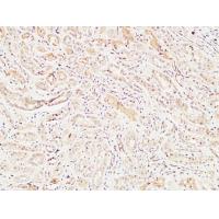 MIB1 Polyclonal Antibody