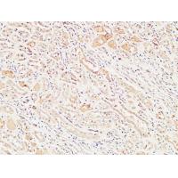 MIB1 Polyclonal Antibody