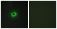 MIC2 Polyclonal Antibody