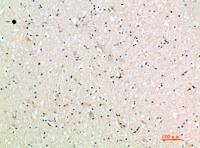 MIG Polyclonal Antibody
