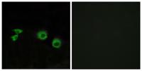 MIP-T3 Polyclonal Antibody