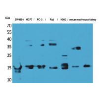 MK Polyclonal Antibody