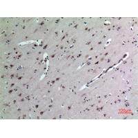 MK Polyclonal Antibody