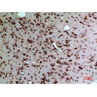 MK Polyclonal Antibody