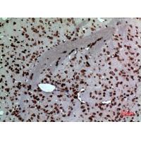 MK Polyclonal Antibody