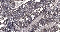 MLF1 Polyclonal Antibody