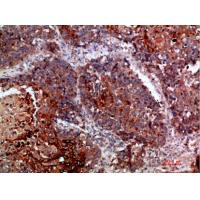 MLL Polyclonal Antibody