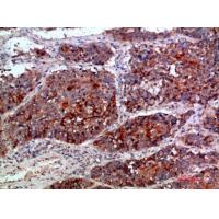 MLL Polyclonal Antibody