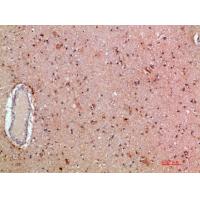 MLL Polyclonal Antibody