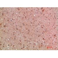 MLL Polyclonal Antibody