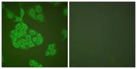 MMP-11 Polyclonal Antibody