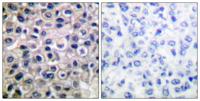 MMP-14 Polyclonal Antibody