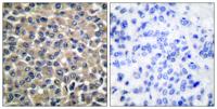 MMP-19 Polyclonal Antibody