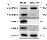 MMP-9 Polyclonal Antibody