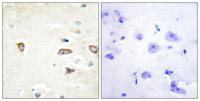 MRCKβ Polyclonal Antibody