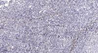 Ribosomal Protein S11 Polyclonal Antibody
