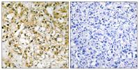 mtTFA Polyclonal Antibody