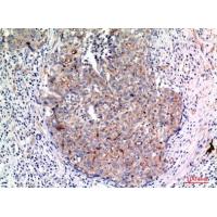 Mucin 1 Polyclonal Antibody