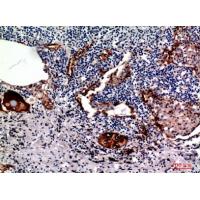 Mucin 1 Polyclonal Antibody