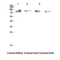 MUM1 Polyclonal Antibody