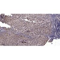 MUM1 Polyclonal Antibody